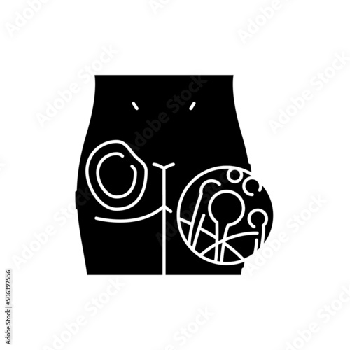 Cutaneous mucormycosis color line icon. Human diseases.