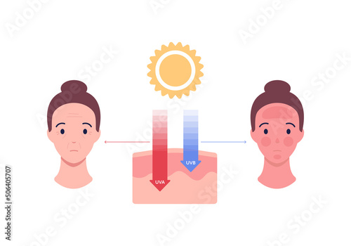 Uv rays and visible light healthcare infographic. Vector flat people illustration. UVA, UVB arrow penetrate skin layers. Sunburn and aging female avatar. Design for uv awareness month.
