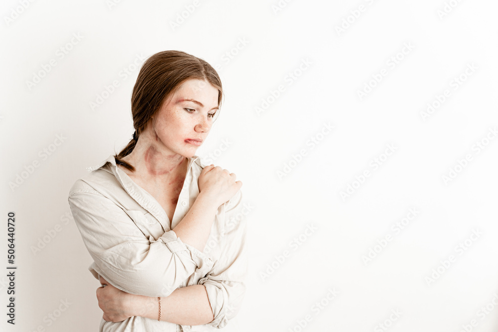 portrait of a girl on a white background victim of domestic violence