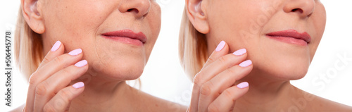 Middle age close up woman face before after cosmetic procedures. Skin care for wrinkled face. Before-after anti-aging facelift treatment. Facial skincare and contouring. Beauty