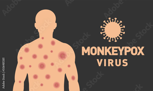 Monkeypox virus. Monkeypox virus banner design. Scars on the body. Vector design.