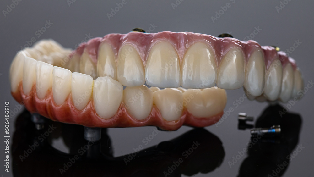 composition of two dental prostheses of the upper and lower jaws with a beautiful gum on a gray background composition of two dental prostheses of the upper and lower jaws with a beautiful gum on a gray background
