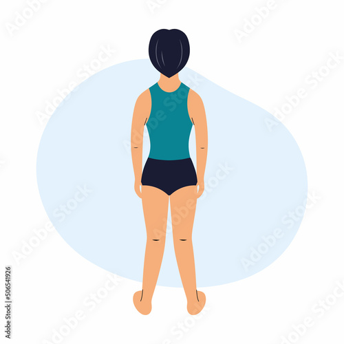 Valgus deformity foot. Boy with orthopedic problem. Curvature of legs and joints.