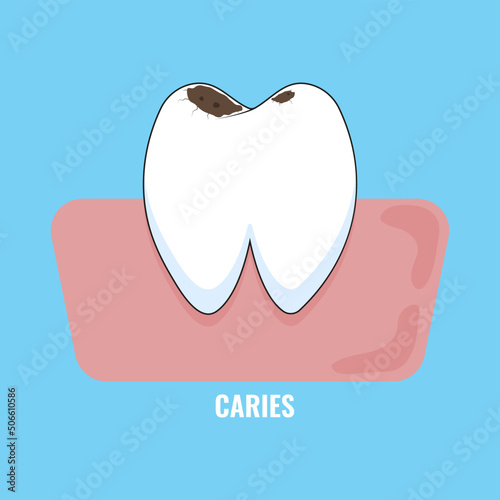 White caries tooth icon.  Vector illustration. Dental care concept. 
