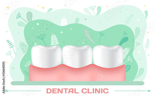 Human jaw with normal teeth and prosthesis above dental implant structure. Tooth after dental procedure. Surgical implant in oral cavity. Treatment, dentistry, oral care. Healthy tooth in human gum