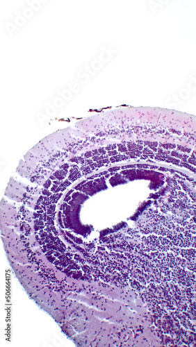 Midbrain. Histology  structure of the frog's optic tectum. Hematoxlyn and eosin stain. photo