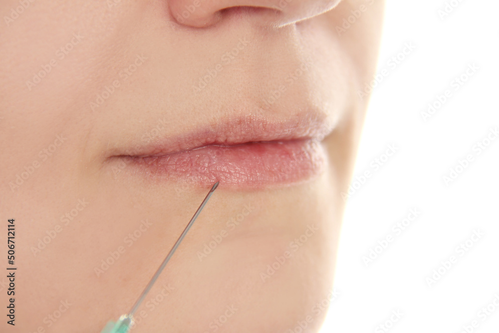 Obraz premium Woman receiving filler injection in lips, closeup
