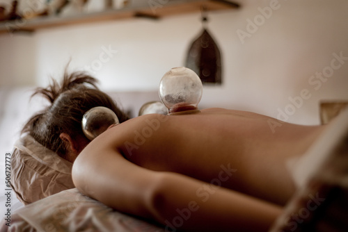 Relaxed young woman receiving cupping treatment on back, traditional chinese medicine. photo