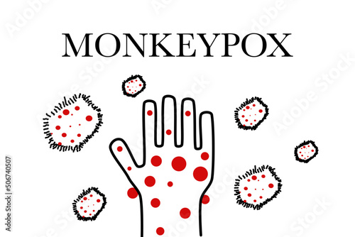Monkeypox cell infection pandemic.symptom monkeypox cell with doctor in laboratory lab confirm.Monkeypox is a rare disease infection with virus.Sexual Health in uk.infection in Africa Europe.icon.