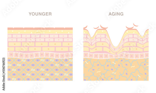 Cross section of subcutaneous tissue. Smooth younger skin and wrinkled aging skin. Pale colored illustration in flat cartoon style.