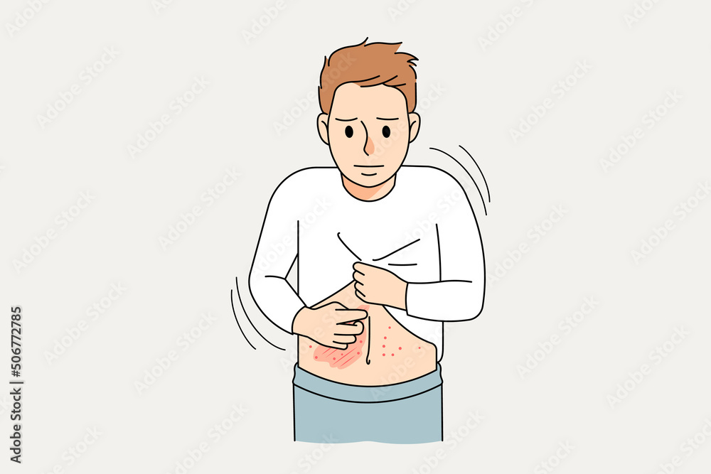 Obraz premium Unhealthy boy child suffer from skin itchiness