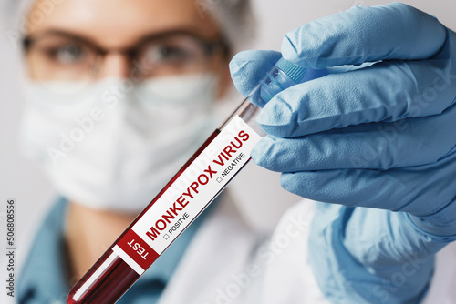 Female nurse with vacutainer with monkeypox blood sample for test photo