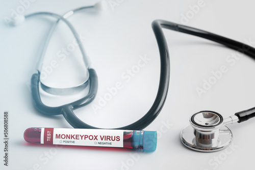 Vacutainer with monkeypox blood sample for testing photo