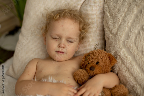 Little toddler girl with chicken pox in bed, playing at home, quarantine isolation
