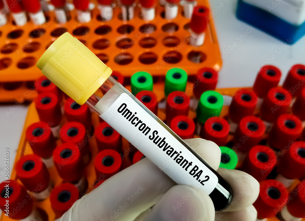 Fototapeta premium Blood sample for SARS-COV-2, Covid-19 Omicron Subvariant test at medical laboratory. BA.2