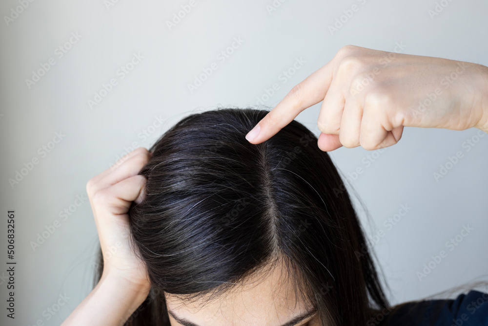 Young woman shows her black gray hair roots. Hair loss problem. Young woman shows her black gray hair roots. Hair loss problem.