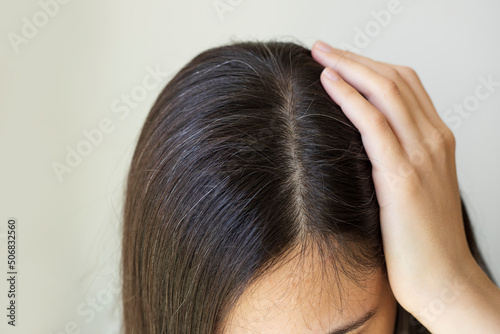 Young woman shows her black gray hair roots. Hair loss problem. 
