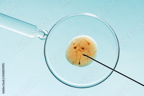 Картината върху платно In vitro fertilisation concept