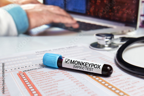 Doctor's work table with a blood tube diagnosed infection with Monkeypox (MPXV) disease. medical office work table with a blood sample from a patient positive for monkey pox virus (MPXV)