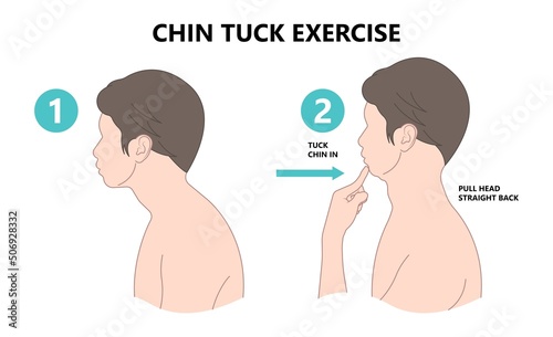 Chin Tuck Head Text neck lift pain nerve deep flexor spine inflamed bad correct poor good phone smart tablet laptop use work from home chiropractor strain upper back Jaw Joint outlet stress injury photo