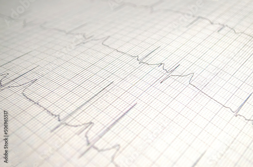 Cardiogram chart with medical table closeup, for Surgeon heart record, selective focus