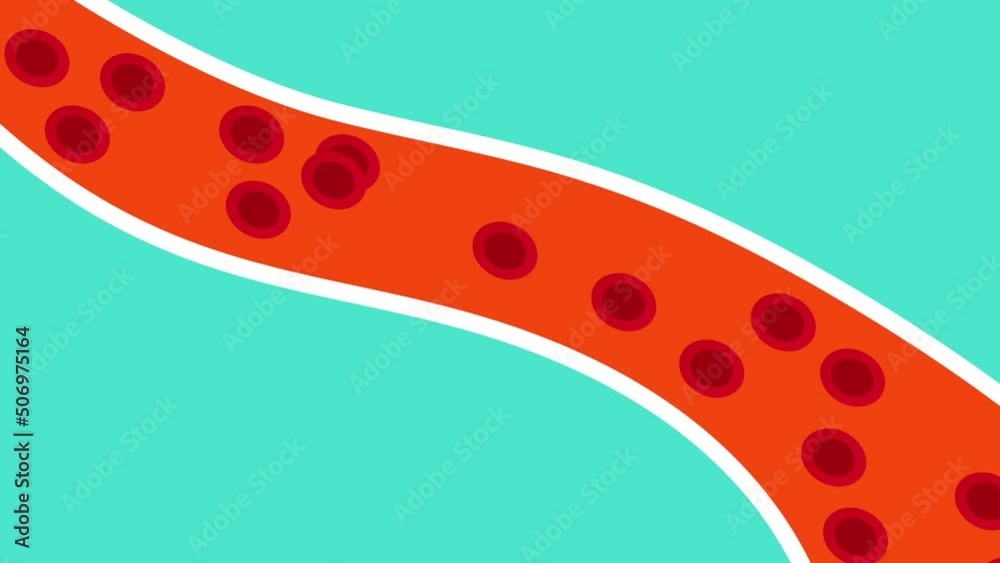 Fat blocking blood circulation inside a blood vessel 4K animation. Human anatomy and heart blockage effect 4K footage. Body fat blocks the blood vessel and red blood cells. Blood clotting animation.