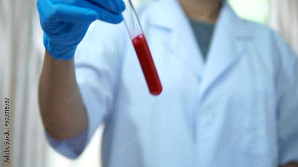 Scientists test blood with coronavirus in a lab Scientists test blood with coronavirus in a lab