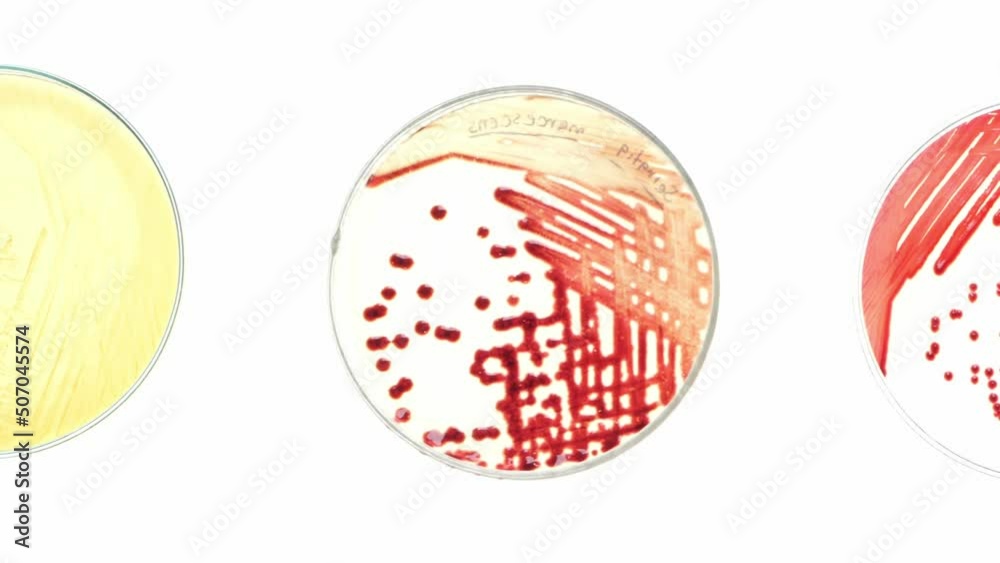 Top view closeup panning scene on colony of bacteria on nutrient media in petri dish, experiment of microbial culture in microbiology science laboratory Top view closeup panning scene on colony of bacteria on nutrient media in petri dish, experiment of microbial culture in microbiology science laboratory