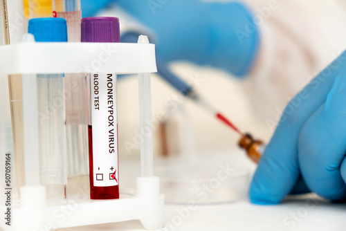 A test tube with a sample of blood infected with monkeypox, close-up.In the blurry background, a medic uses an automatic dispenser in the laboratory.Epidemic of monkeypox in Europe and the USA. photo