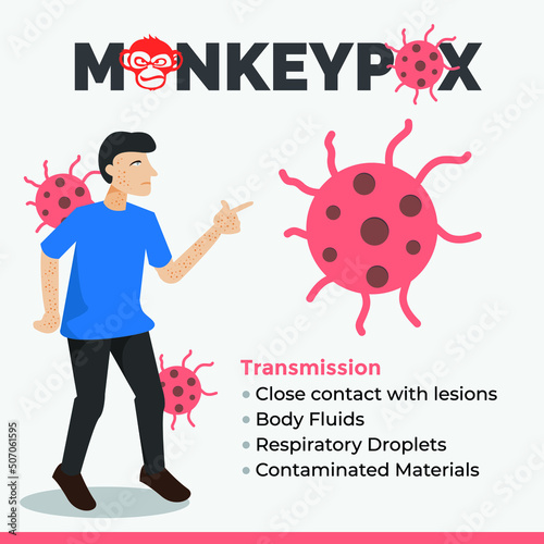 Monkeypox Virus Transmission through Vector Illustration