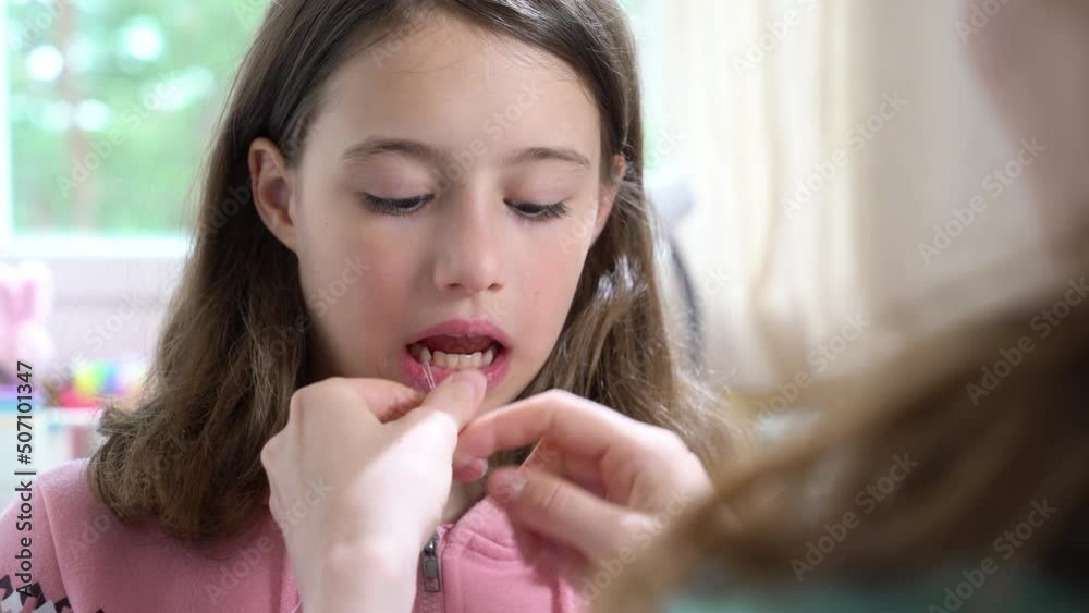 A mother pulling out a baby tooth to her little daughter using dental floss. A mother pulling out a baby tooth to her little daughter using dental floss.
