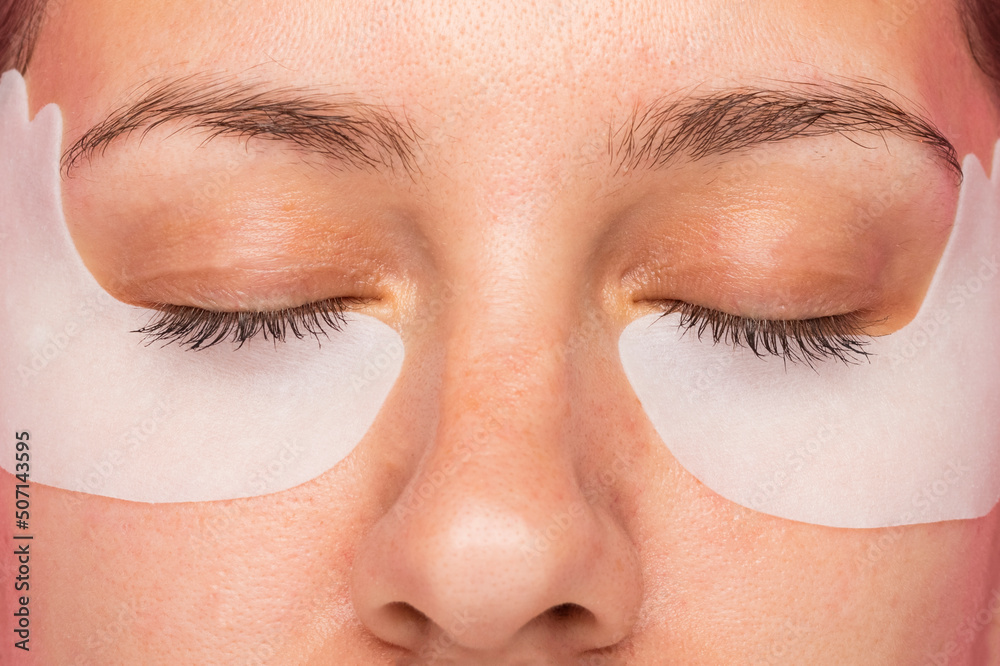 Girl with closed eyes and white patches under the eyes on her face. Facial skin care concept. Close-up