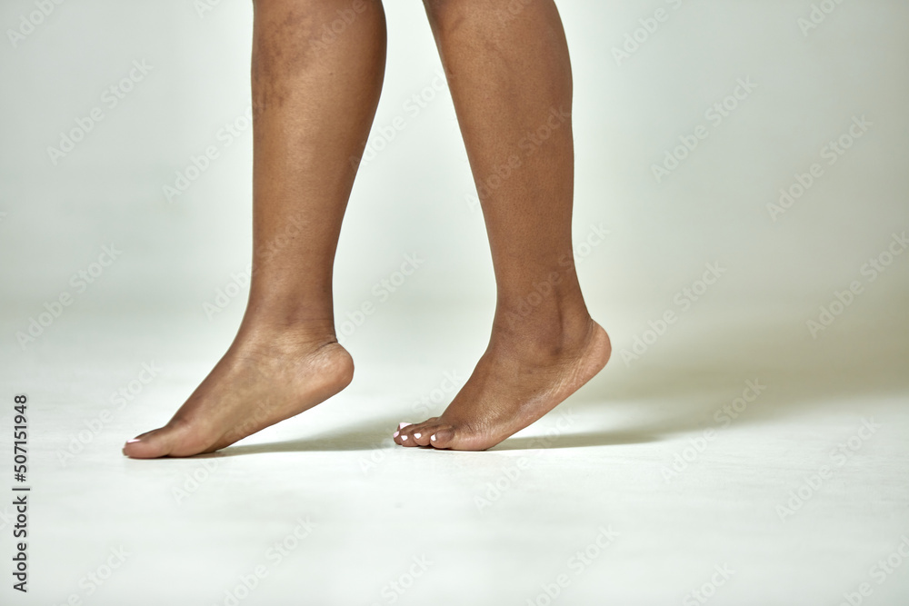 African american female feet with fat ankles. Black woman legs step on tiptoe, walking. Podiatry