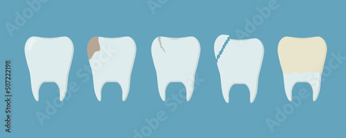 Set of human teeth with different injuries. Healthy tooth, tooth with caries, plaque, crack and broken. Template for stomatology or dentistry. Dental care Concept