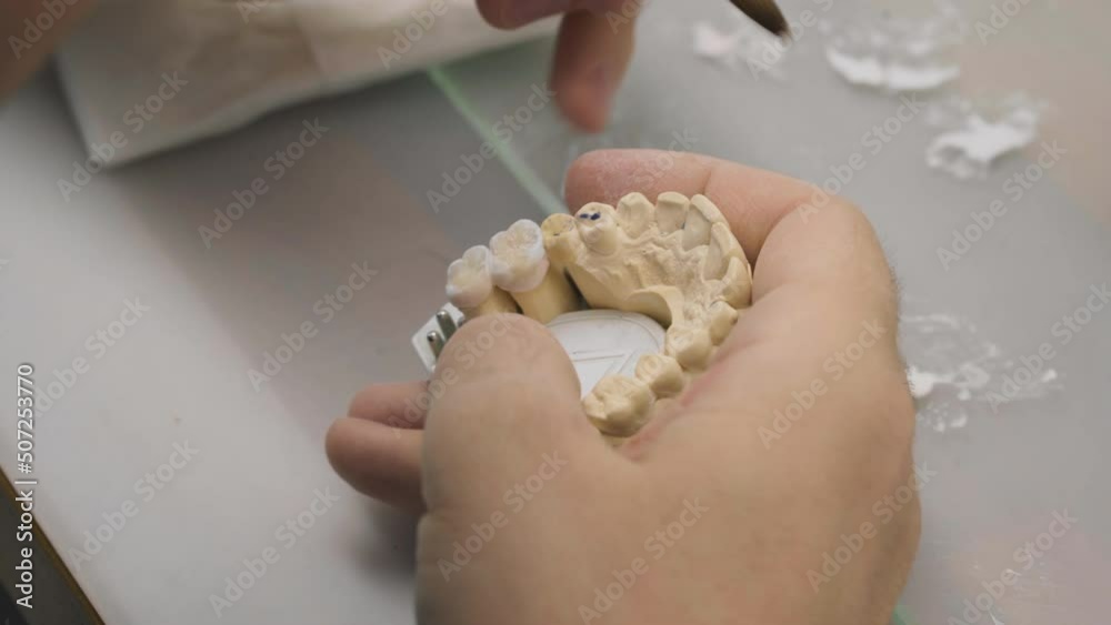 Orthodontist cuts artificial tooth with small tools for dental crown