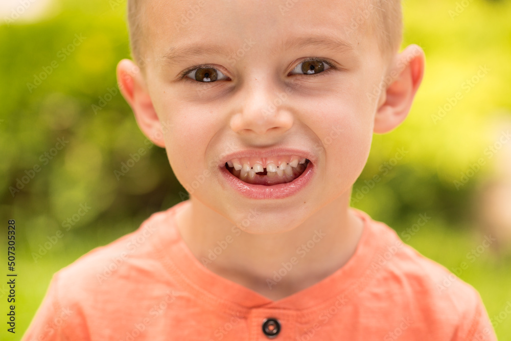 five-year-old boy making faces. A five-year-old blond boy makes faces while standing on the street in sunny weather
