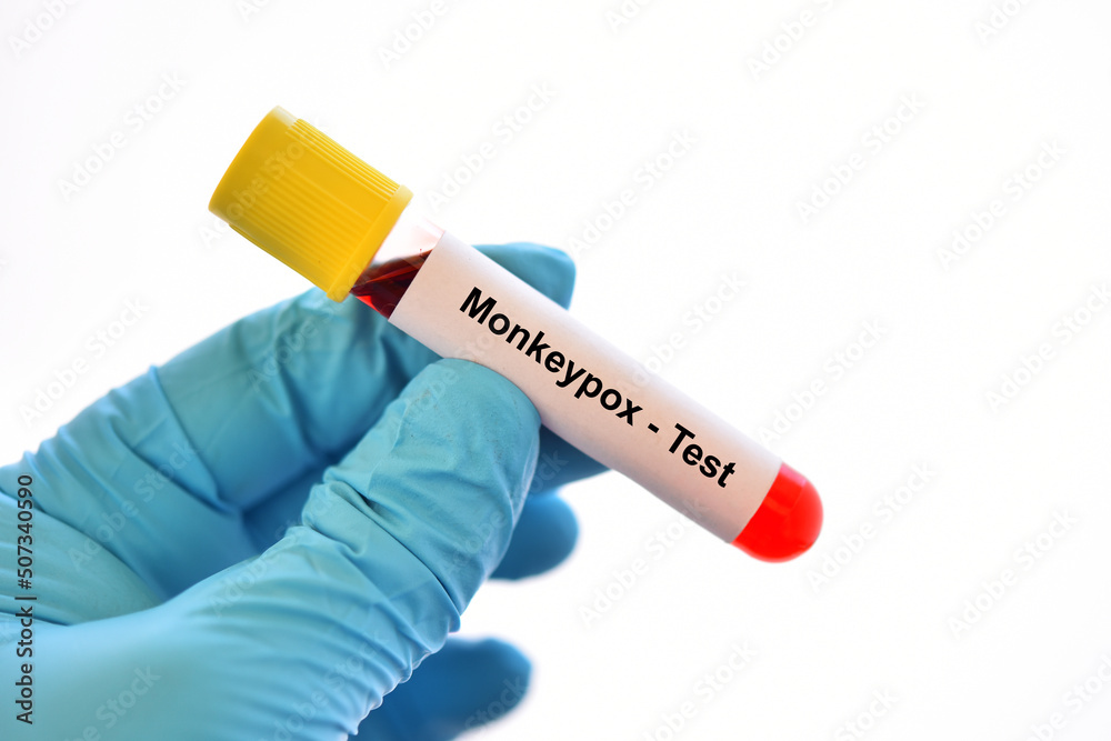 Obraz premium Blood sample tube for Monkeypox virus test, new epidemic disease in 2022