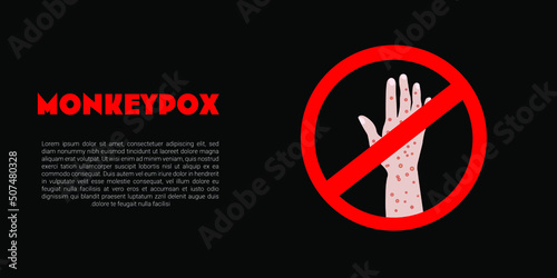Monkeypox virus banner. Vector EPS illustration.