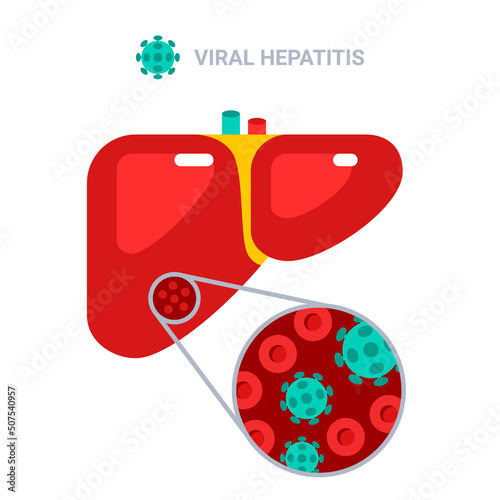 Viral hepatitis concept poster, liver flat icon with virus particles and blood cells in microscope. Vector illustration. A, B, C, D viral type