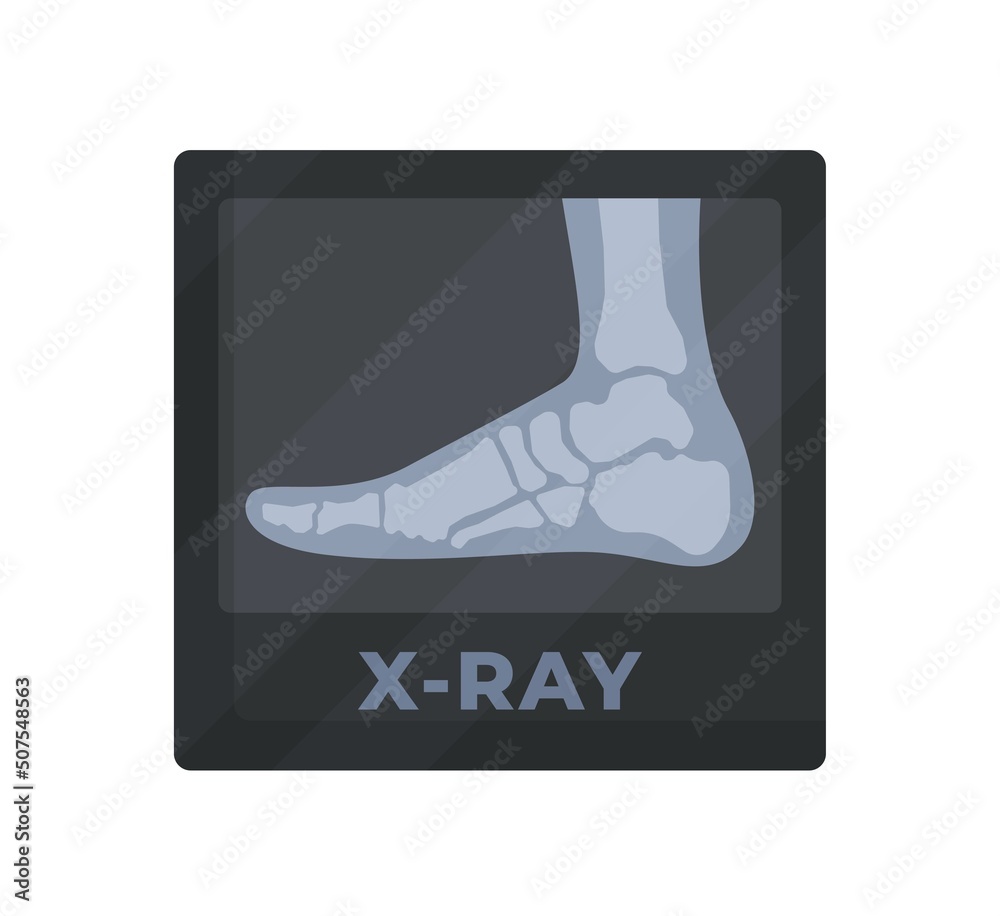 Vector illustration of x-ray leg. Painful leg. Whole and healthy leg ...