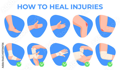 First aid for hand injuries. Bandage of a human hand. Vector illustration