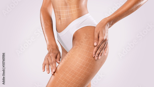 Anti-Cellulite Treatment. Lifting Up Lines Drawn On Perfect Female Body In Underwear