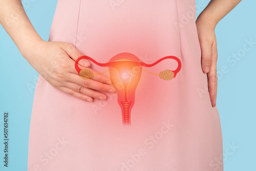 Woman suffering from pelvic pain with uterus and ovaries anatomy. Cause of pain inclued dysmenorrhea, edometriosis, PCOS, PMS, STDs, gynecologic cancer. Reproductive system and woman health problems. photo