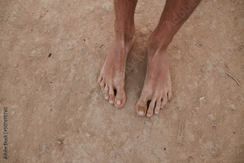 The guy stands on the sand barefoot. Legs close up. Sea. Ocean