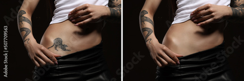 Woman before and after laser tattoo removal procedure on black background, closeup. Collage with photos, banner design photo