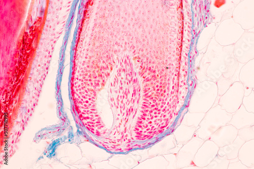 Scalp and hair follicles of human under the microscope in Lab. photo