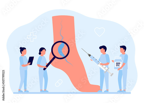 Varicose and vein thrombosis, treatment leg. Tiny Doctor with drugs and medical instruments medication foot with diseased veins. Examination blood vessels and veins, health care. Vector Illustration