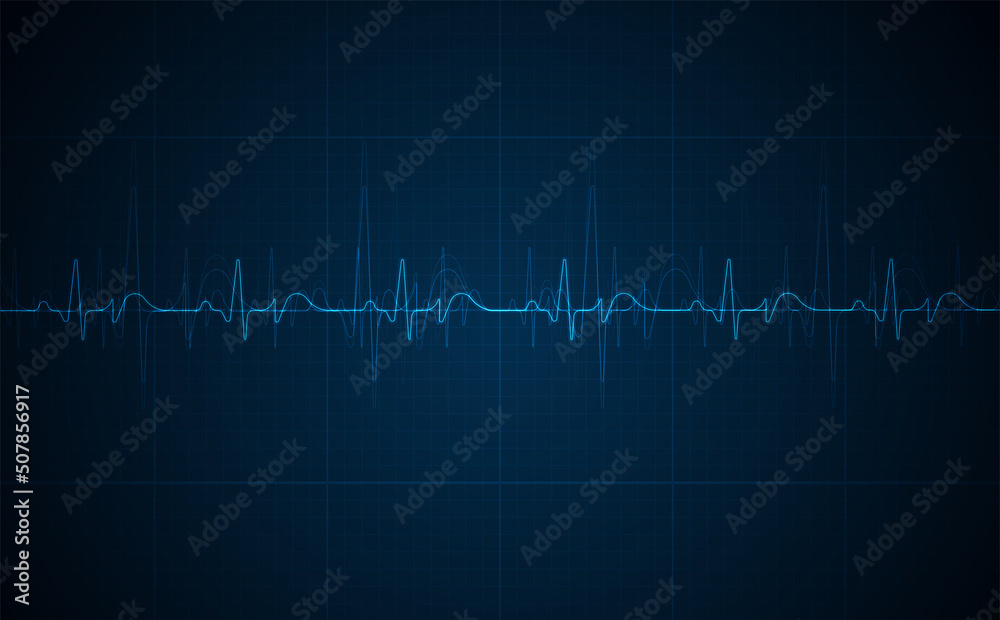 Emergency ekg monitoring. Blue glowing neon heart pulse. Heart beat. Electrocardiogram Emergency ekg monitoring. Blue glowing neon heart pulse. Heart beat. Electrocardiogram