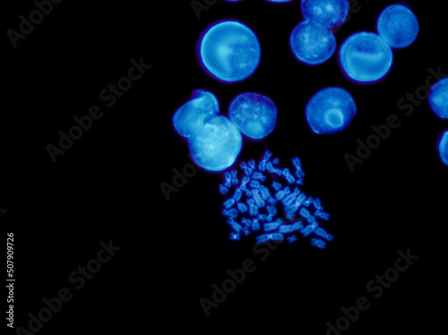Chromosomes under fluorescence microscope, fluorescence in situ hybridization technique, Human chromosomes from blood