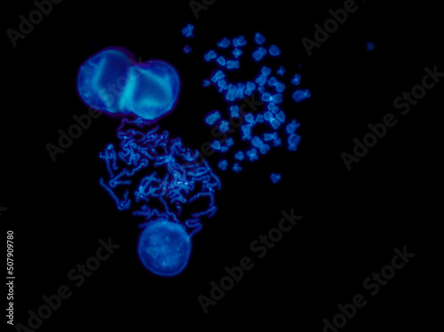 Картината върху платно Chromosomes under fluorescence microscope, fluorescence in situ hybridization te